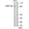 Zinc Finger Protein 148 antibody, A04433-1, Boster Biological Technology, Western Blot image 
