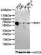 Estrogen Receptor 1 antibody, CSB-RA172909A0HU, Cusabio, Western Blot image 