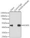 Short-chain specific acyl-CoA dehydrogenase, mitochondrial antibody, GTX55489, GeneTex, Immunoprecipitation image 