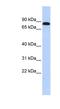 Desmocollin 3 antibody, NBP1-59227, Novus Biologicals, Western Blot image 