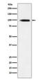 GIT ArfGAP 1 antibody, M02140-1, Boster Biological Technology, Western Blot image 