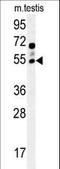 Gamma-Aminobutyric Acid Type A Receptor Gamma2 Subunit antibody, LS-C166330, Lifespan Biosciences, Western Blot image 