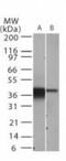 NFKB Inhibitor Alpha antibody, GTX12134, GeneTex, Western Blot image 