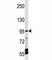 Transient Receptor Potential Cation Channel Subfamily V Member 5 antibody, F45042-0.4ML, NSJ Bioreagents, Western Blot image 