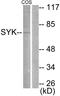 Spleen Associated Tyrosine Kinase antibody, LS-C117583, Lifespan Biosciences, Western Blot image 