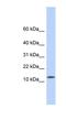 CMT1A Duplicated Region Transcript 4 antibody, NBP1-55440, Novus Biologicals, Western Blot image 