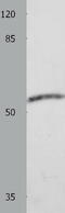 Cyclase Associated Actin Cytoskeleton Regulatory Protein 2 antibody, TA322503, Origene, Western Blot image 