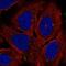 Adenylate Cyclase 7 antibody, NBP2-58945, Novus Biologicals, Immunofluorescence image 