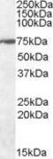 Protein Wiz antibody, GTX47563, GeneTex, Western Blot image 