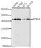 DNA Topoisomerase II Alpha antibody, GTX65863, GeneTex, Western Blot image 