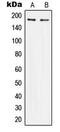 Insulin Receptor Substrate 1 antibody, MBS820213, MyBioSource, Western Blot image 