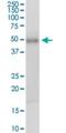 Testis Specific Serine Kinase 1B antibody, H00083942-D01P, Novus Biologicals, Western Blot image 