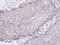 Cholinergic Receptor Nicotinic Alpha 4 Subunit antibody, GTX113653, GeneTex, Immunohistochemistry paraffin image 