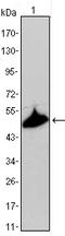Keratin 15 antibody, STJ97982, St John