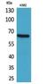 Activated Leukocyte Cell Adhesion Molecule antibody, A01788, Boster Biological Technology, Western Blot image 