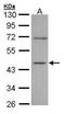 Inositol-Tetrakisphosphate 1-Kinase antibody, GTX107974, GeneTex, Western Blot image 