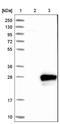 RAB29, Member RAS Oncogene Family antibody, NBP1-87173, Novus Biologicals, Western Blot image 