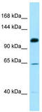 Structural Maintenance Of Chromosomes 6 antibody, TA343360, Origene, Western Blot image 