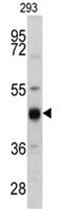 Keratin 13 antibody, AP17527PU-N, Origene, Western Blot image 
