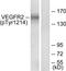 Kinase Insert Domain Receptor antibody, TA311979, Origene, Western Blot image 