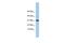 Chromosome 9 Open Reading Frame 153 antibody, GTX45430, GeneTex, Western Blot image 