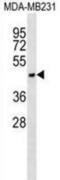 Asialoglycoprotein Receptor 1 antibody, abx028618, Abbexa, Western Blot image 