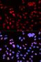 MutL Homolog 1 antibody, orb48457, Biorbyt, Immunofluorescence image 