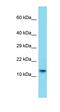 Centrosomal Protein 85 Like antibody, orb326713, Biorbyt, Western Blot image 