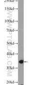 PDZ and LIM domain protein 1 antibody, 11674-1-AP, Proteintech Group, Western Blot image 