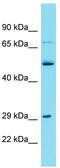 Transmembrane Protein 199 antibody, TA334781, Origene, Western Blot image 