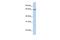 Transmembrane 9 Superfamily Member 1 antibody, GTX46658, GeneTex, Western Blot image 