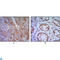 Hedgehog Interacting Protein antibody, LS-C812642, Lifespan Biosciences, Immunohistochemistry paraffin image 