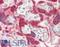 Transglutaminase 2 antibody, LS-B12446, Lifespan Biosciences, Immunohistochemistry paraffin image 