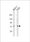 HERV-K_19q12 provirus ancestral Env polyprotein antibody, PA5-49533, Invitrogen Antibodies, Western Blot image 