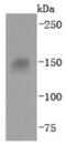 Integrin Subunit Alpha 5 antibody, NBP2-67883, Novus Biologicals, Western Blot image 