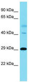 DNA polymerase-transactivated protein 2 antibody, TA330526, Origene, Western Blot image 