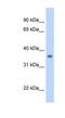 Sarcoglycan Gamma antibody, NBP1-59744, Novus Biologicals, Western Blot image 