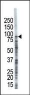 Ubiquitin Specific Peptidase 8 antibody, PA5-12006, Invitrogen Antibodies, Western Blot image 