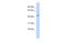 Keratin, type I cytoskeletal 24 antibody, A13429, Boster Biological Technology, Western Blot image 