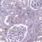 Transmembrane Protein 132E antibody, HPA070608, Atlas Antibodies, Immunohistochemistry frozen image 