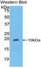 C-X-C Motif Chemokine Ligand 16 antibody, MBS2013650, MyBioSource, Western Blot image 