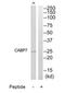 Calcium Binding Protein 7 antibody, TA316190, Origene, Western Blot image 