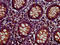 Fermitin Family Member 2 antibody, LS-C672404, Lifespan Biosciences, Immunohistochemistry paraffin image 