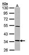 NADH:Ubiquinone Oxidoreductase Subunit A5 antibody, orb73548, Biorbyt, Western Blot image 