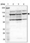Eukaryotic Translation Initiation Factor 4E Nuclear Import Factor 1 antibody, PA5-51680, Invitrogen Antibodies, Western Blot image 