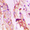 Phosphoinositide-3-Kinase Regulatory Subunit 1 antibody, LS-C358831, Lifespan Biosciences, Immunohistochemistry paraffin image 