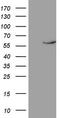 Nuclear Receptor Subfamily 1 Group D Member 2 antibody, LS-C798311, Lifespan Biosciences, Western Blot image 