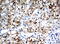 Gamma-Butyrobetaine Hydroxylase 1 antibody, UM570085, Origene, Immunohistochemistry paraffin image 