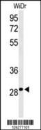 Nicotinamide Riboside Kinase 1 antibody, 64-049, ProSci, Western Blot image 