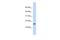 Putative uncharacterized protein encoded by NCRNA00114 antibody, A19506, Boster Biological Technology, Western Blot image 